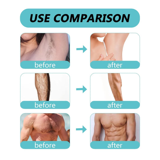 SurtiWala.pk™ - Ecrin Hair Removal Spray for Men and Women - 150 ml