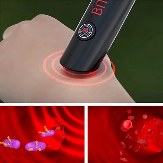 SurtiWala.pk™ - Mosquito Bite Helper