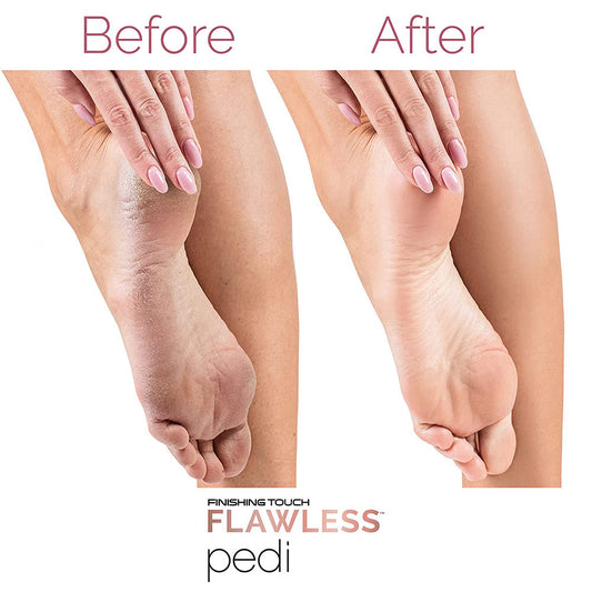 SurtiWala.pk™ - Finishing Touch Flawless Pedi Electronic Tool File and Callus Remover, Pedicure