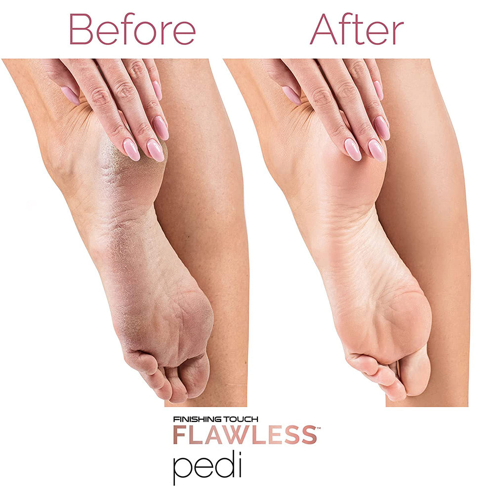 SurtiWala.pk™ - Finishing Touch Flawless Pedi Electronic Tool File and Callus Remover, Pedicure
