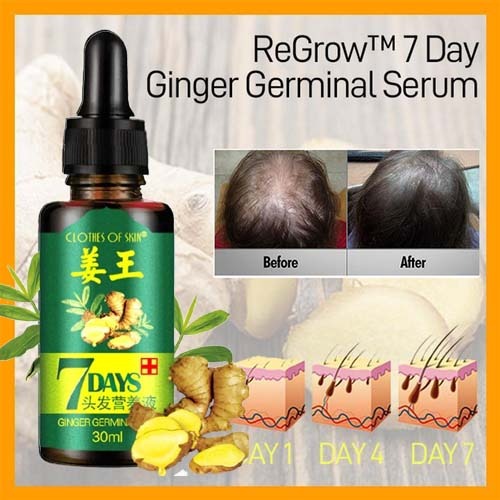 SurtiWala.pk™ - Ginger Germinal Oil Hair Nutrient Solution Hair Growth (30ml) - 50% OFF