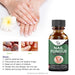 SurtiWala.pk™ - Nail Fungi Treatment Serum