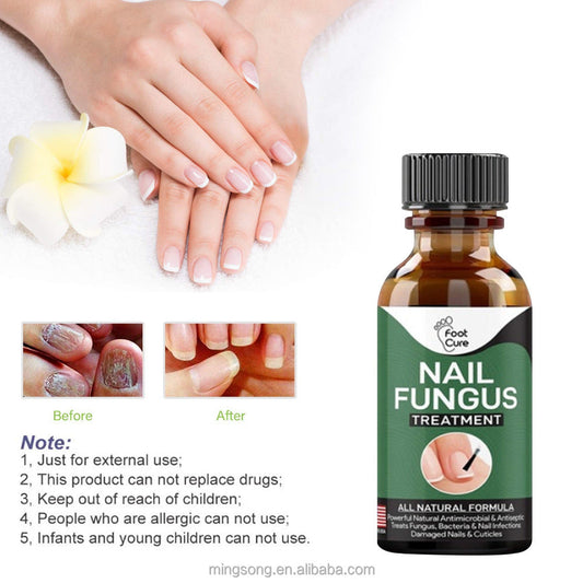 SurtiWala.pk™ - Nail Fungi Treatment Serum