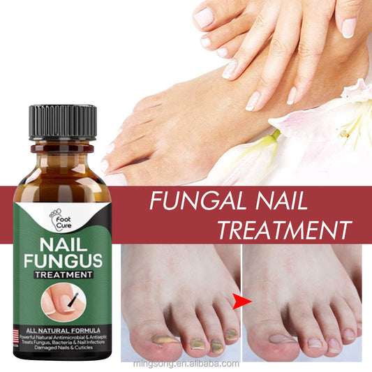 SurtiWala.pk™ - Nail Fungi Treatment Serum